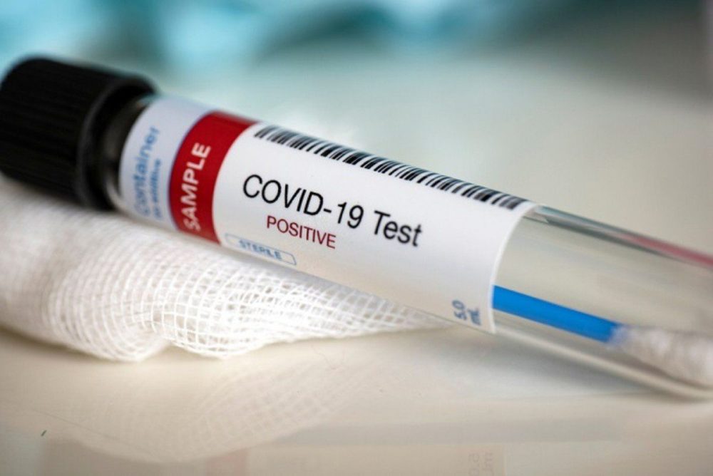 Coronavirus: oggi sono 22 i morti in italia